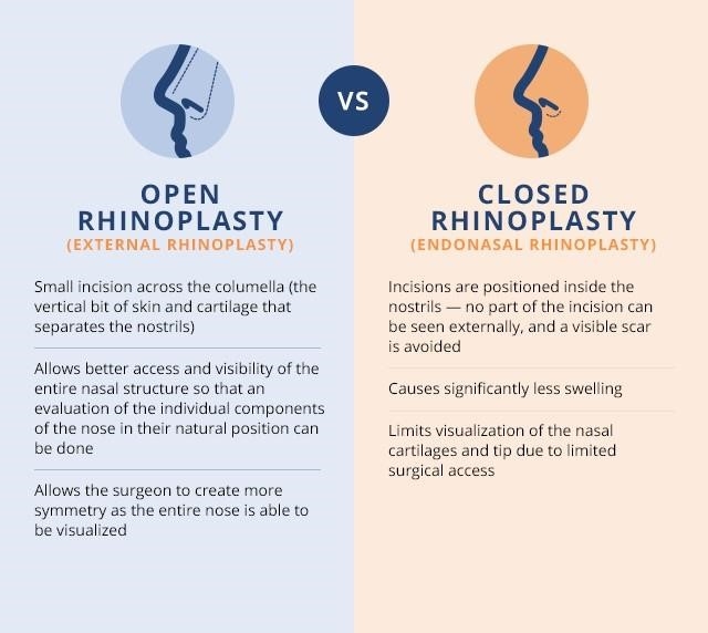 revision rhinoplasty expert